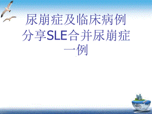 尿崩症及临床病例分享SLE合并尿崩症一例课件.ppt