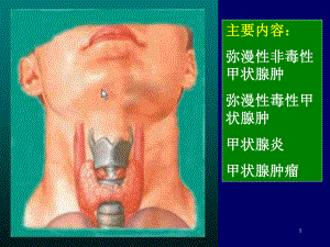 毒性甲状腺肿课件.ppt