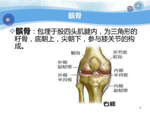 髌骨骨折护理查房课件整理.ppt