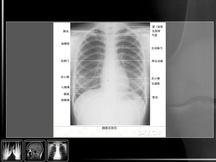 骨科的影像学检查课件.pptx_第3页