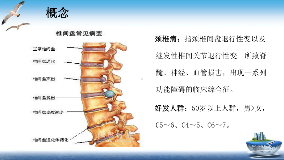 颈椎病的护理查房课件1.pptx_第2页