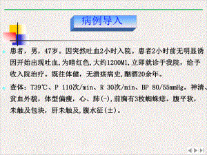 门静脉高压症病人的护理讲述实用版课件.pptx