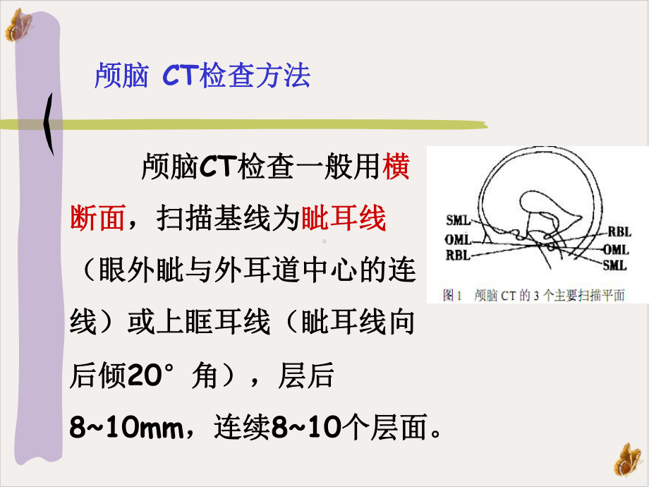 颅脑断面解剖PPT课件.pptx_第2页