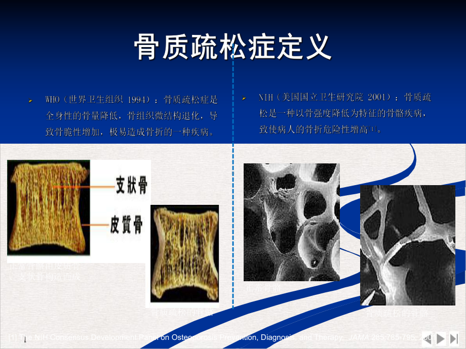 骨质疏松症疾病及治疗药物介绍课件整理.pptx_第2页