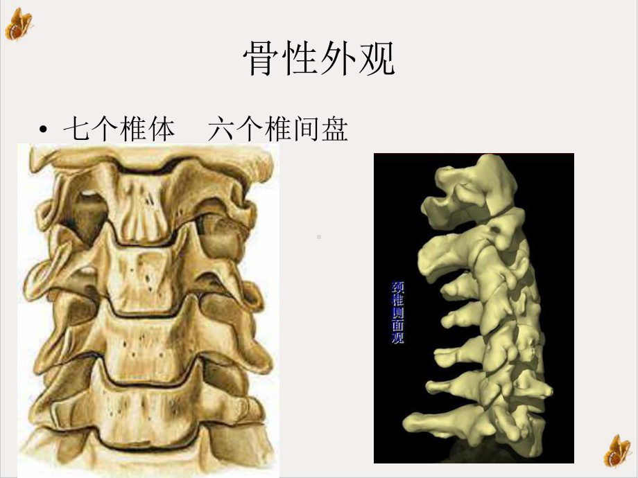 颈椎病的健康教育课件.pptx_第3页