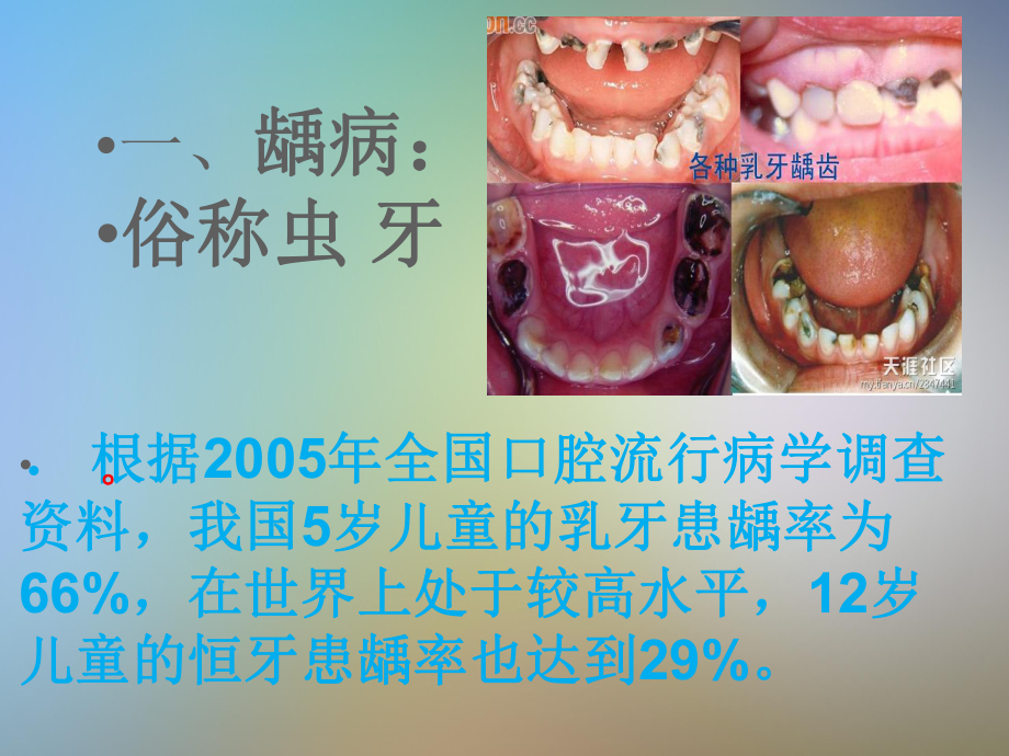 儿童牙病的预防课件.pptx_第3页