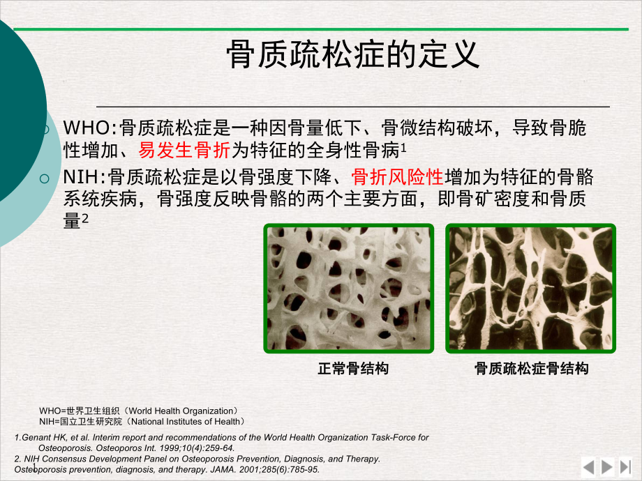 骨质疏松性骨折处理原则实用版课件.pptx_第1页