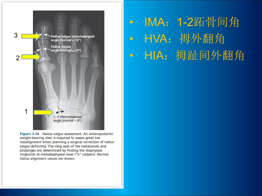 骨科角度测量需求(课件).ppt_第3页