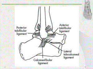 踝关节外侧韧带损伤课件.pptx