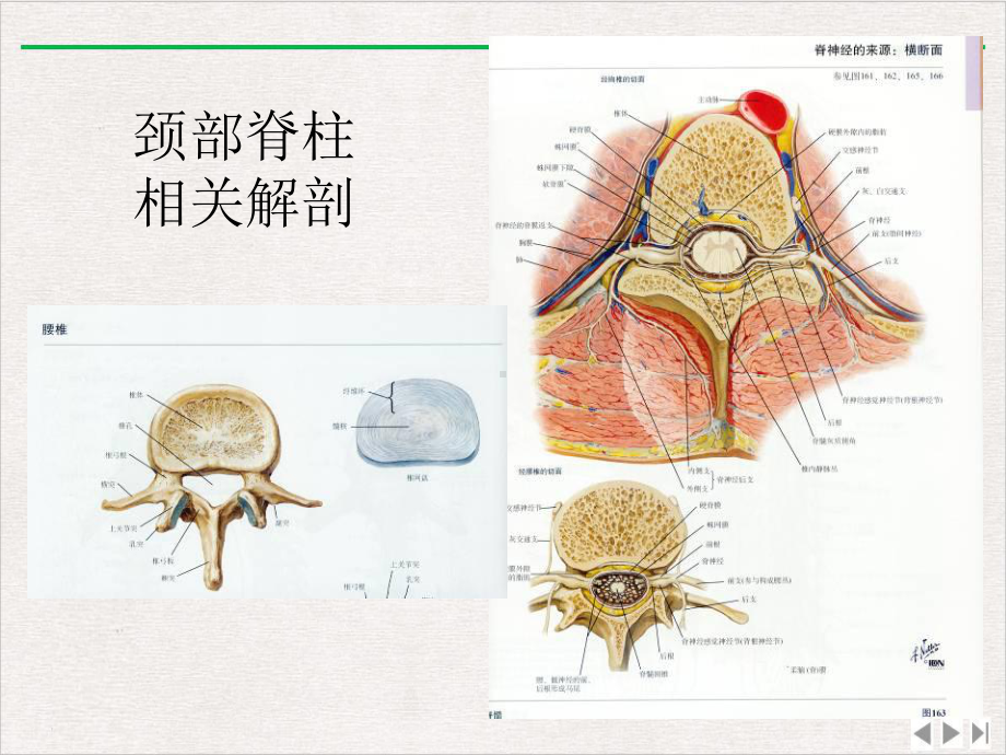 颈椎病的MRI诊断课件完整版.ppt_第3页