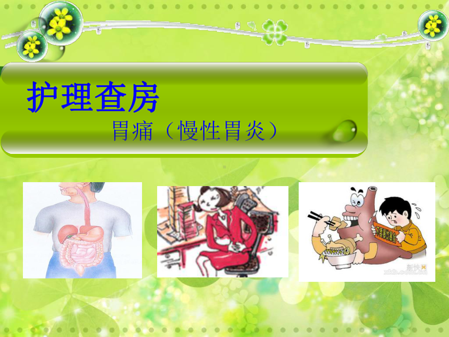 慢性胃炎护理查房优秀课件.ppt_第2页