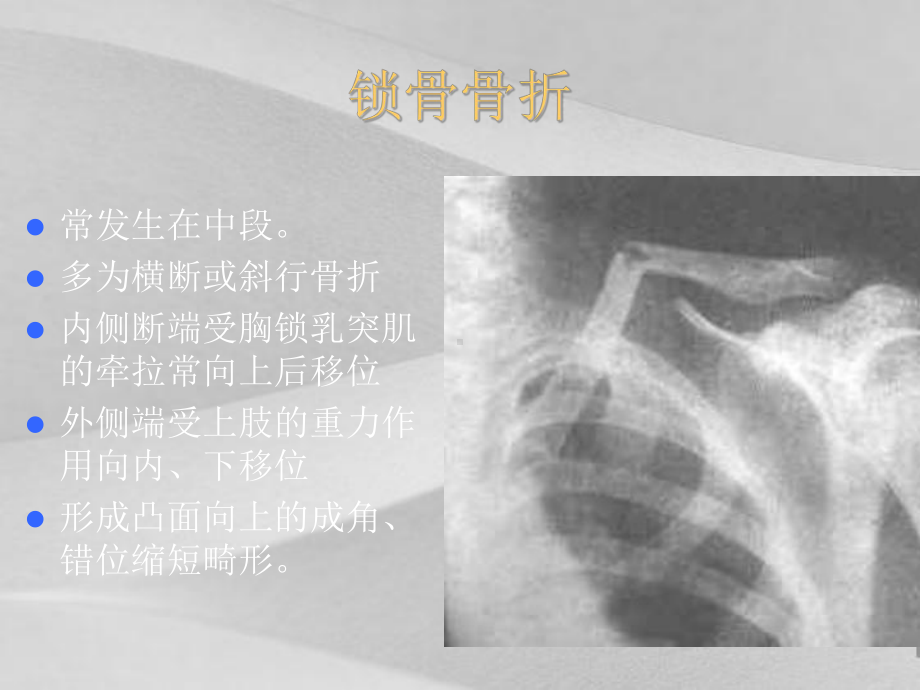 骨科常见疾病医疗管理知识阐述课件.ppt_第3页