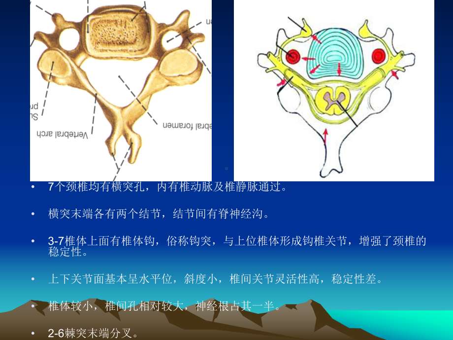 颈腰椎CT诊断课件.pptx_第3页