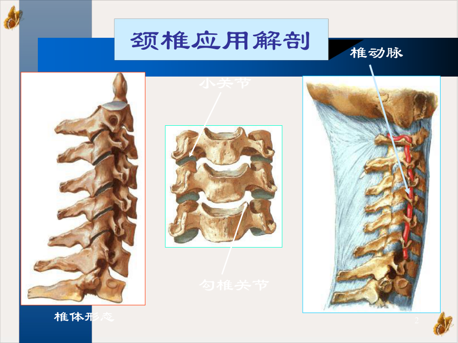 颈椎病护理课件.pptx_第2页