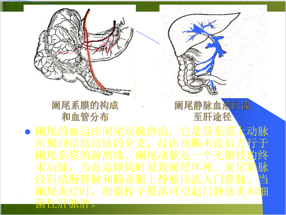 阑尾炎的诊断与手术课件.pptx_第3页