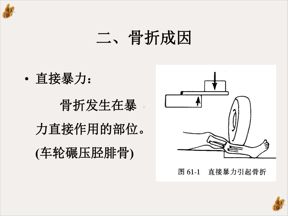 骨与关节损伤教学课件.pptx_第3页