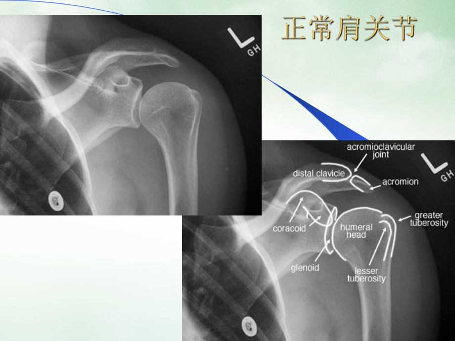 骨科X线片教学讲课课件.pptx_第1页