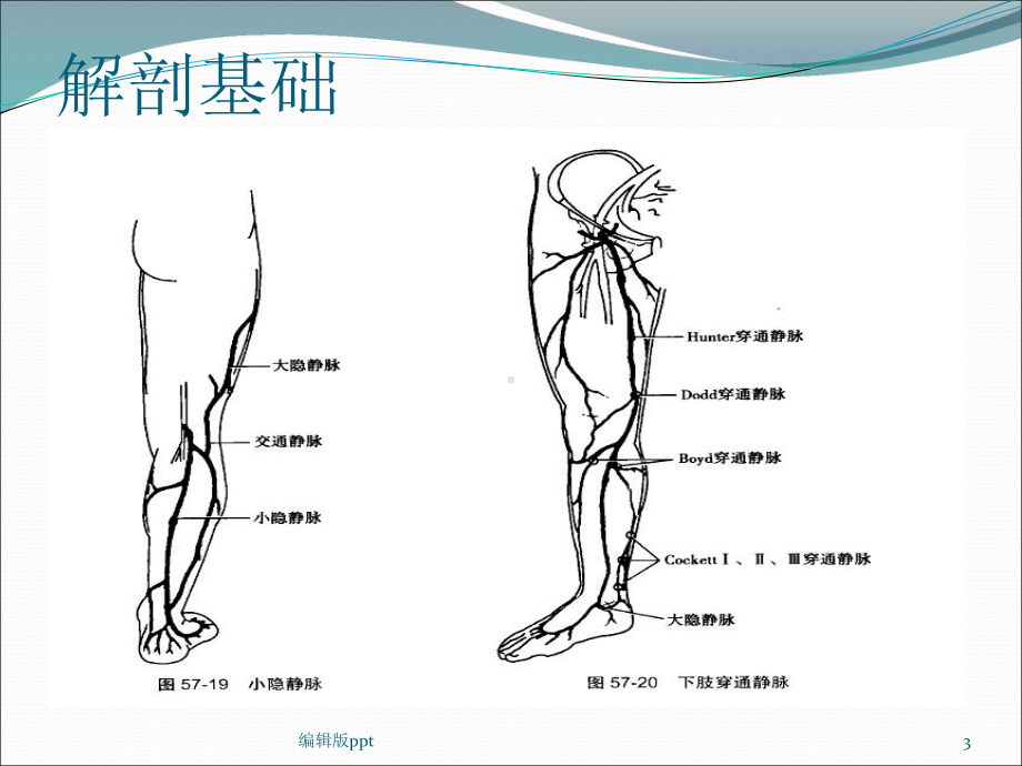 单纯性下肢静脉曲张医学课件.pptx_第3页