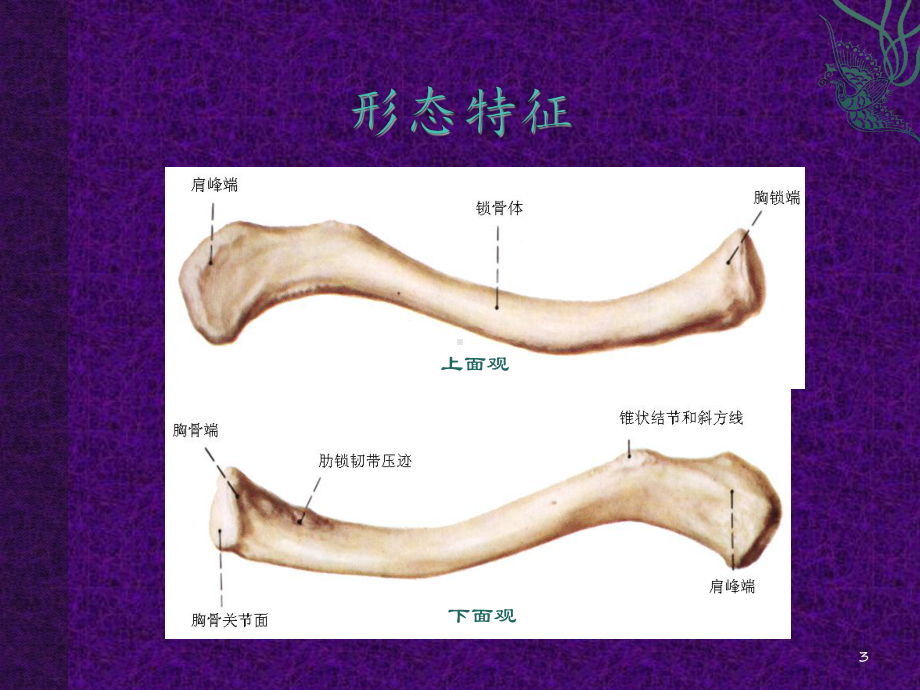 锁骨骨折的诊断和护理课件.ppt_第3页