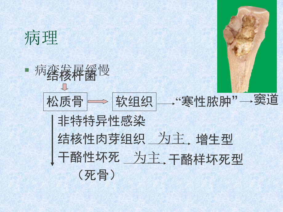 骨关节结核课件(同名228).ppt_第3页