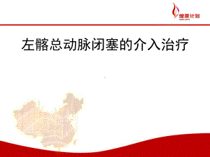 左髂总动脉闭塞的介入治疗课件.ppt