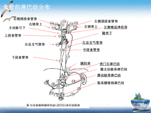 食管癌淋巴结三野清扫课件.pptx