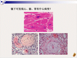 风湿病临床医学课件.pptx