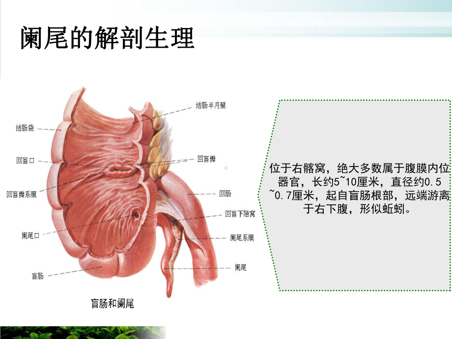 阑尾炎腹腔镜术前术后护理优秀案例课件.ppt_第3页