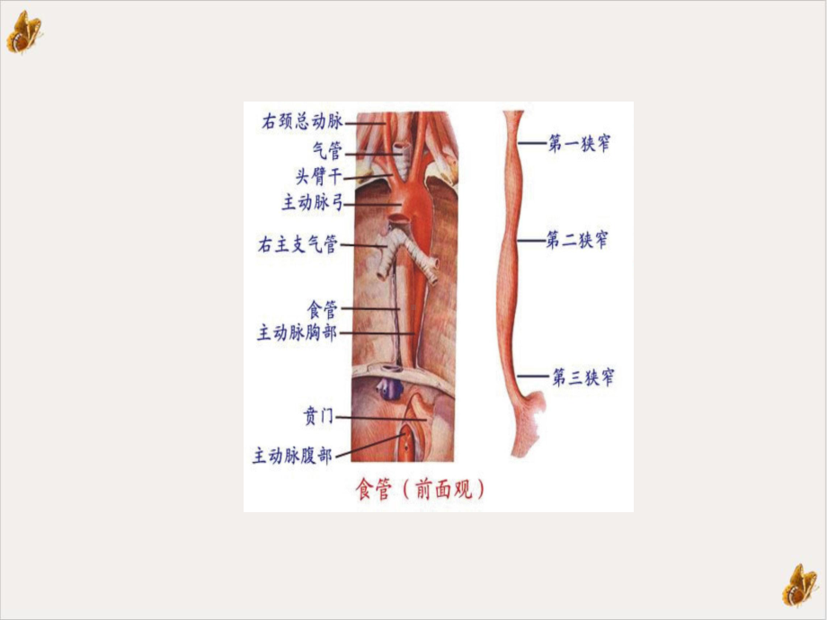 食管癌术后吻合口瘘的护理课件.pptx_第1页