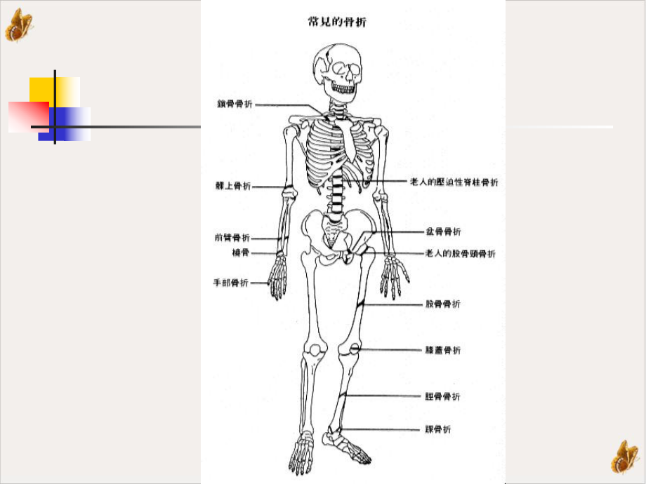 骨与关节损伤病人的护理实用课件.ppt_第2页