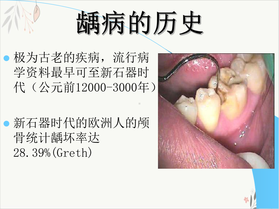 龋病病因临床表现幻灯课件.pptx_第2页