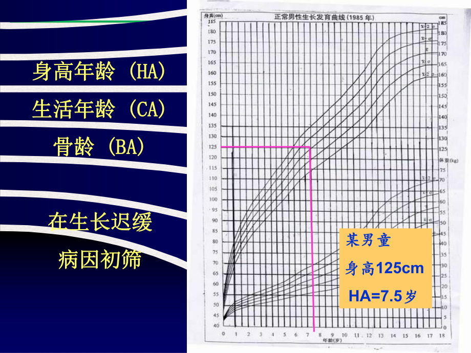 骨龄评估与临床应用课件.pptx_第2页