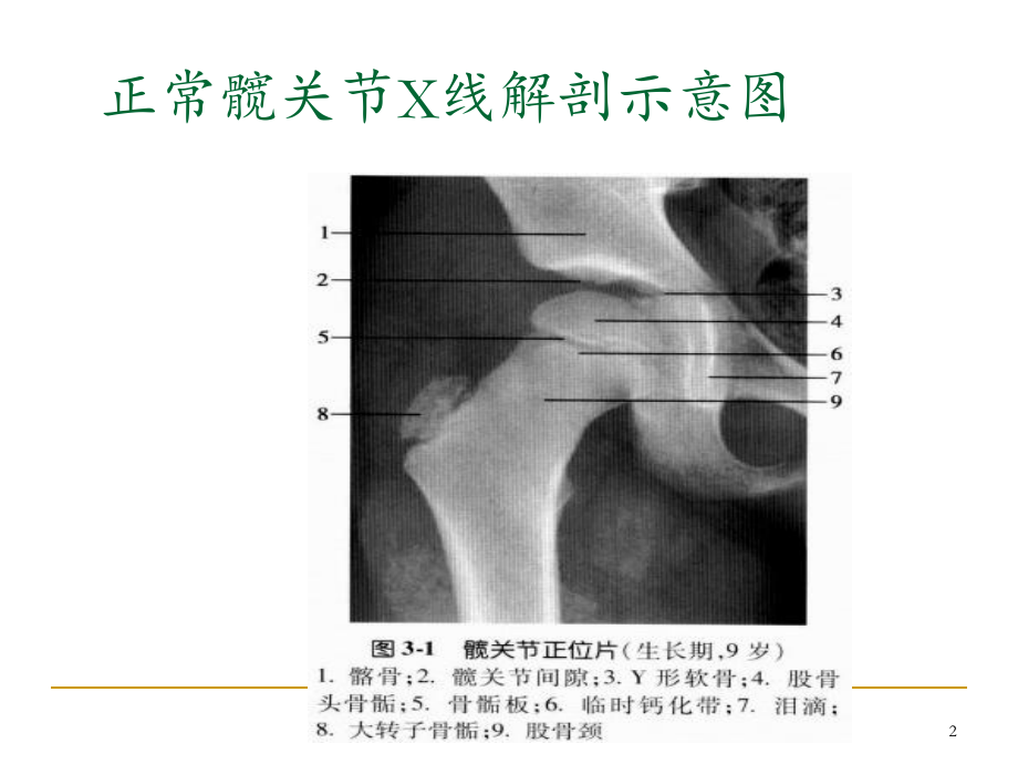 髋关节测量课件.ppt_第2页