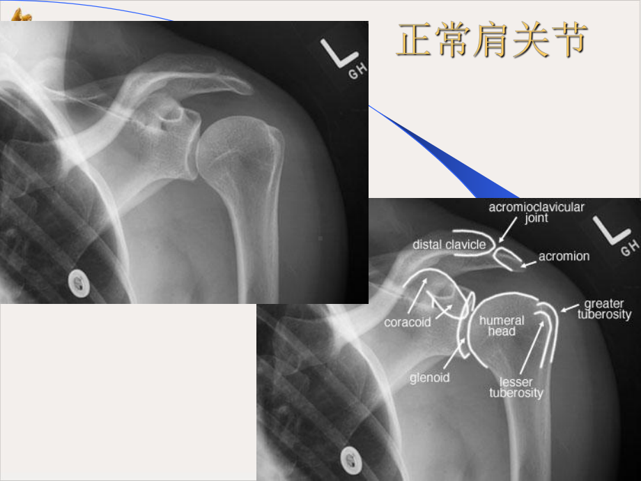 骨科X线片教学课件.pptx_第1页