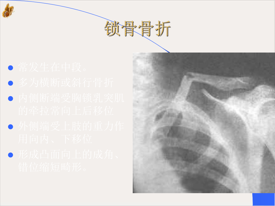 骨科X线片教学课件.pptx_第2页