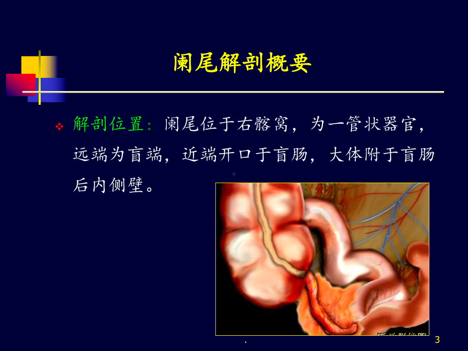 阑尾炎超声诊断课件整理.ppt_第3页