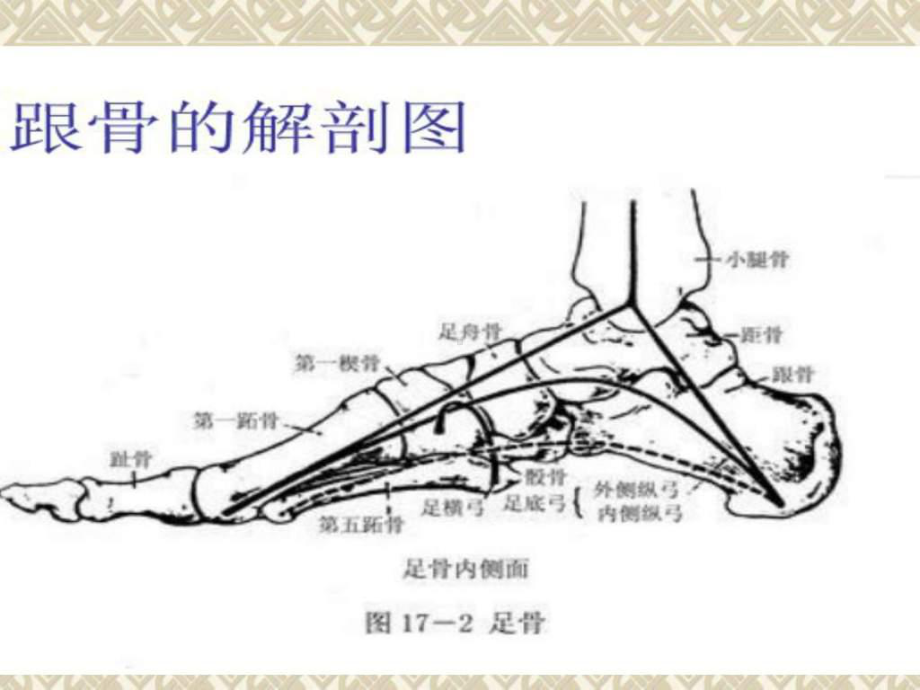 新建-跟骨骨折的护理查房课件.ppt_第3页