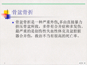 骨盆骨折手术护理查房课件整理.pptx