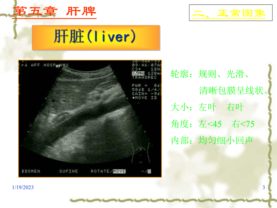 超声诊断学之肝脏疾病超声诊断课件.ppt_第3页