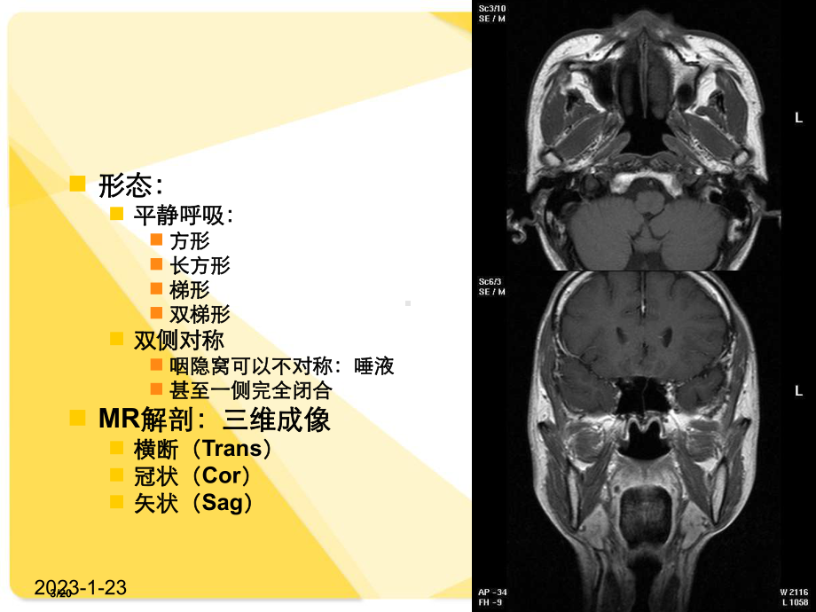 鼻咽癌解剖-鼻咽腔课件整理.ppt_第3页