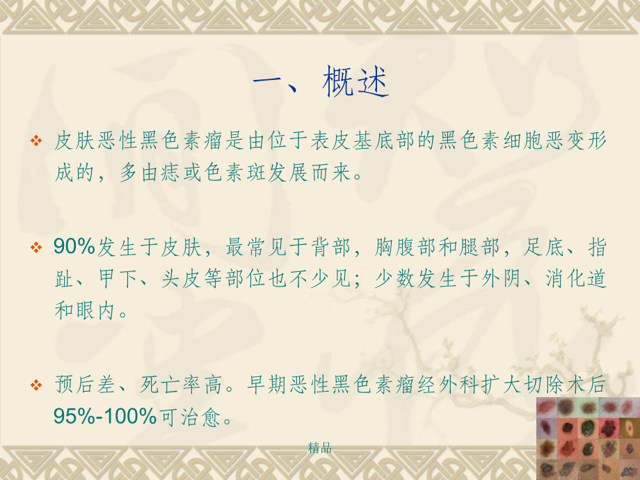 恶性黑色素瘤讲1稿课件.ppt_第3页