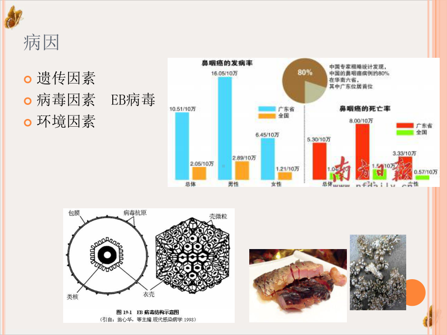 鼻咽癌影像诊断课件.pptx_第2页