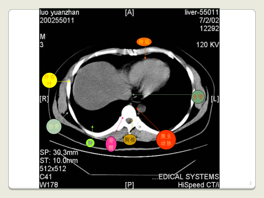 上腹部CT基础图解课件.ppt_第2页