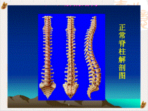 颈肩腰腿痛的康复治疗运动与误区课件1.pptx