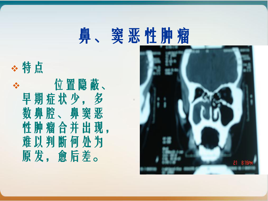 鼻窦恶性肿瘤完整版课件.ppt_第3页