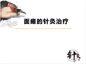 面瘫的针灸治疗课件整理.ppt