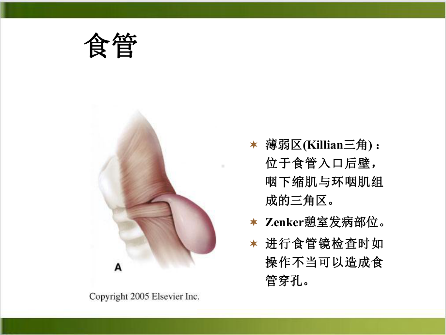 食管异物护理查房课件.ppt_第2页