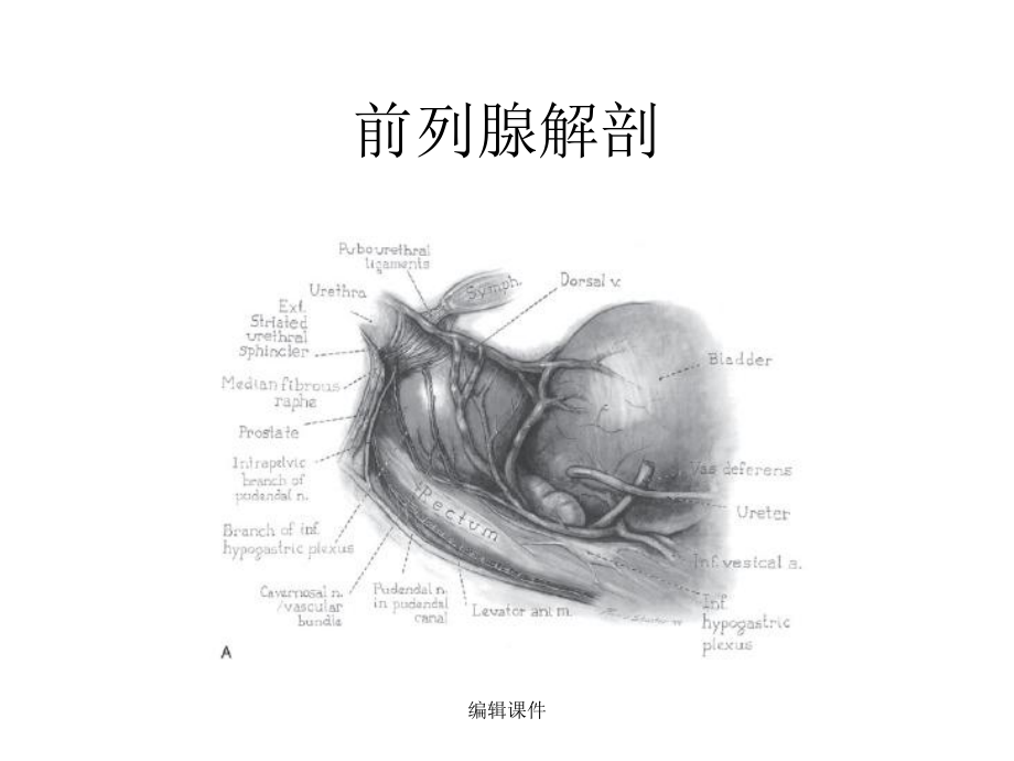 保留控尿功能腹腔镜前列腺癌根治术课件.ppt_第3页