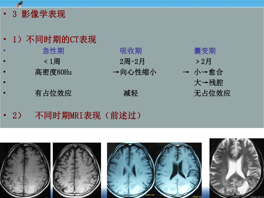 颅内出血CTMRI诊断课件.pptx_第3页