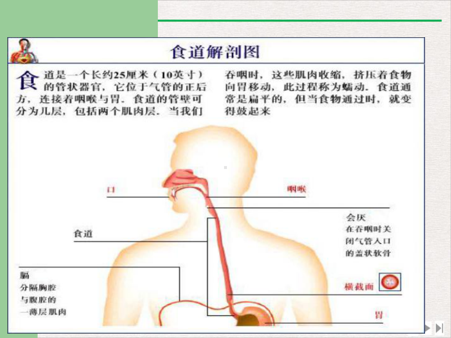 鼻饲并发症的处理素材公开课课件.pptx_第3页